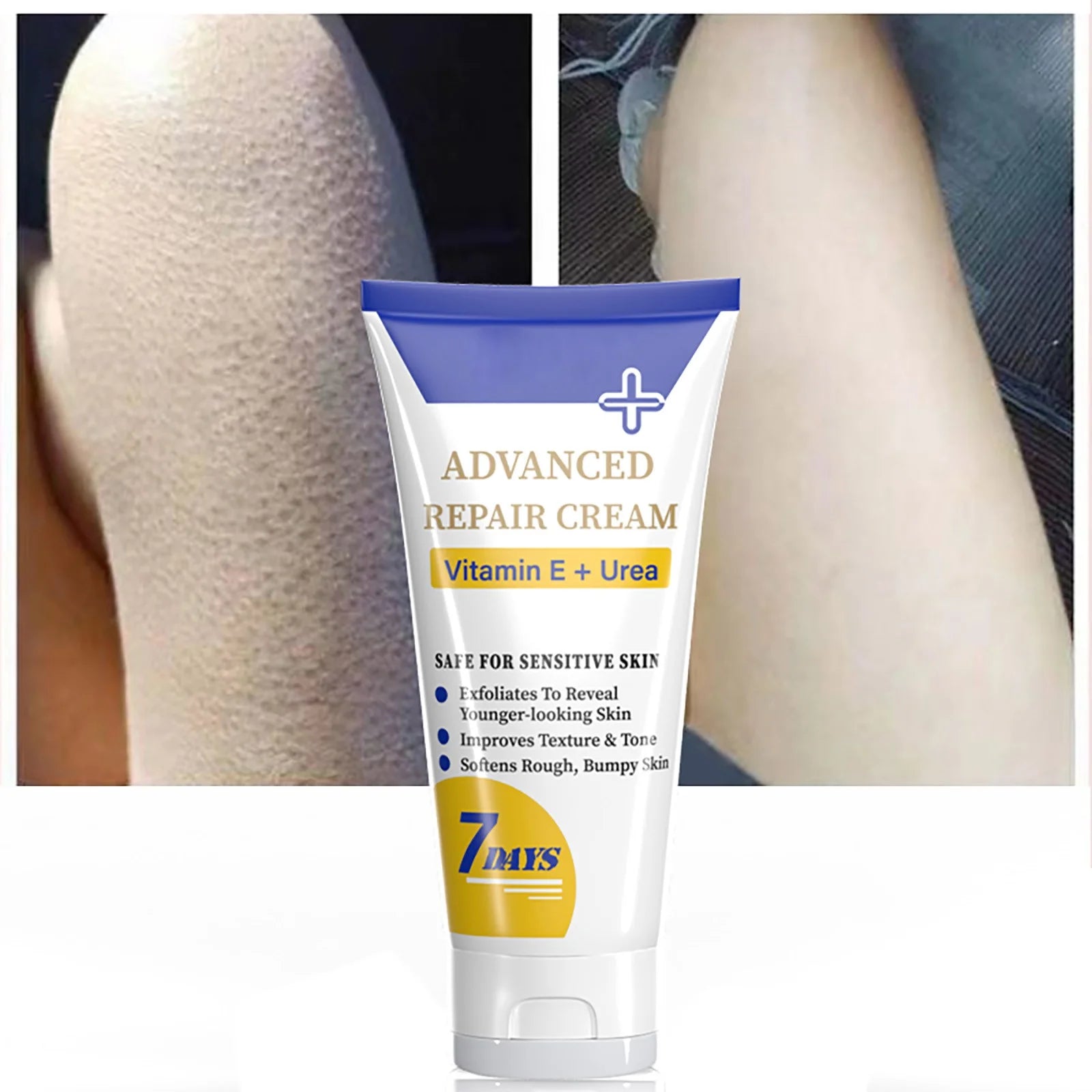 Beauty & Personal Care Keratosis Keratosis Moisturizing Strawberry Legs Body Scrub 