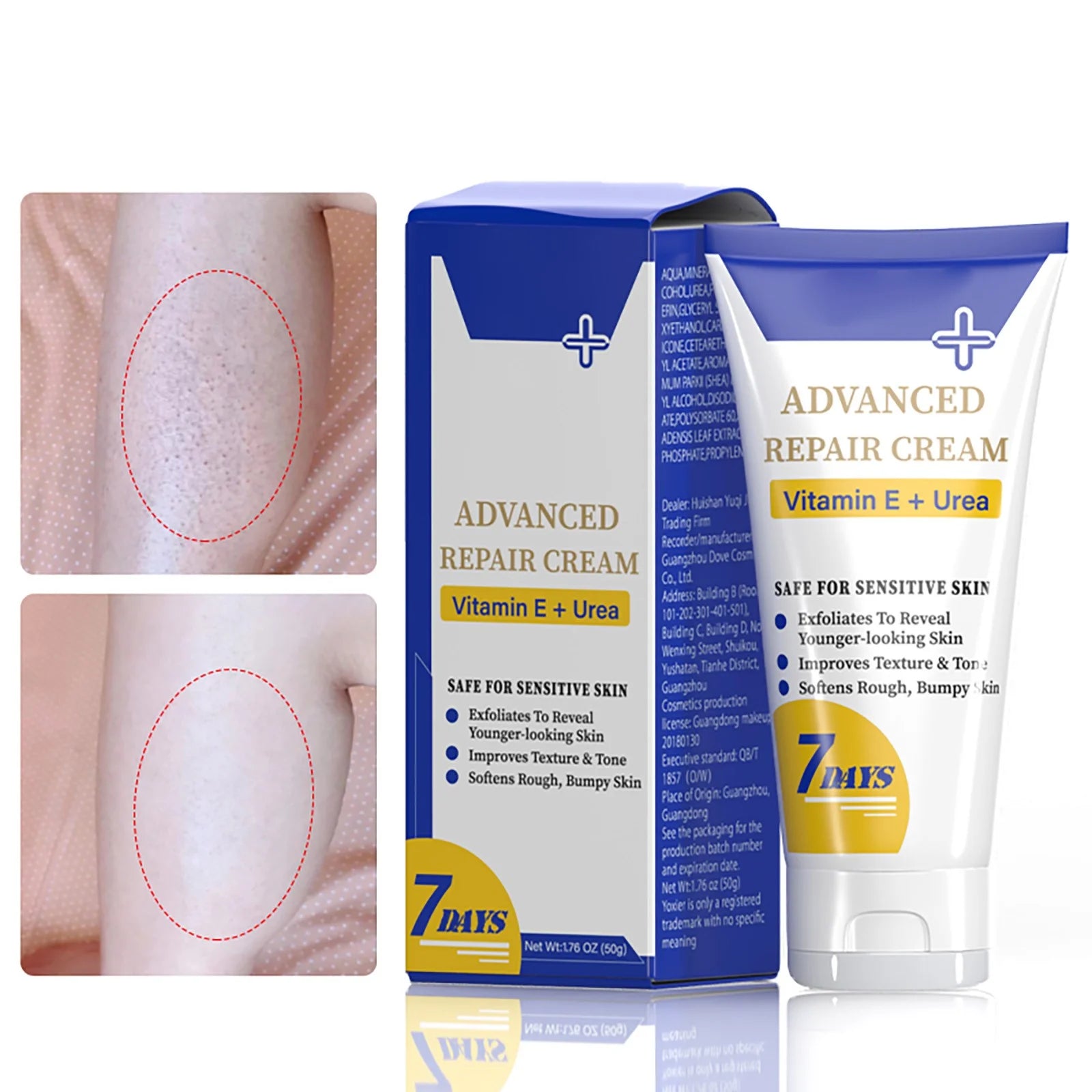 Beauty & Personal Care Keratosis Keratosis Moisturizing Strawberry Legs Body Scrub 
