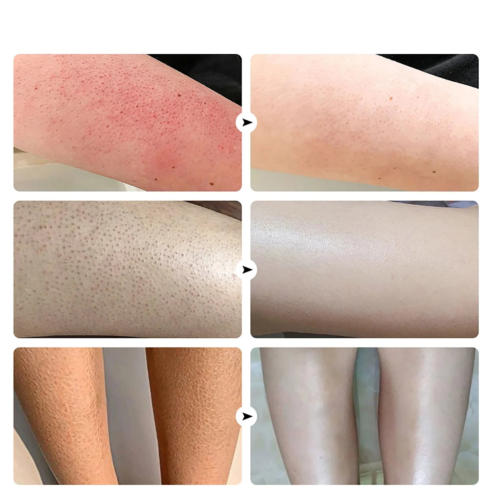 Beauty & Personal Care Keratosis Keratosis Moisturizing Strawberry Legs Body Scrub 