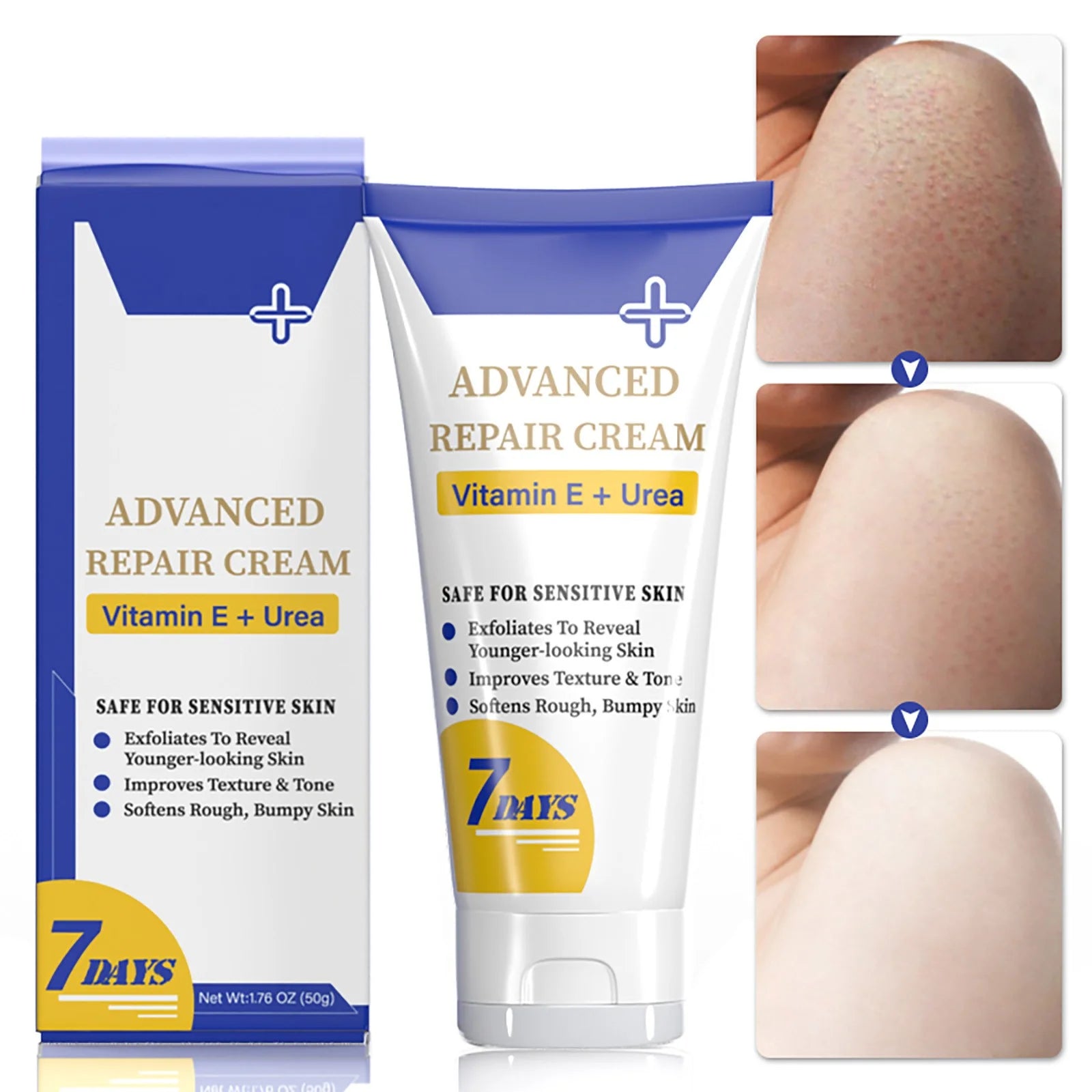 Beauty & Personal Care Keratosis Keratosis Moisturizing Strawberry Legs Body Scrub 