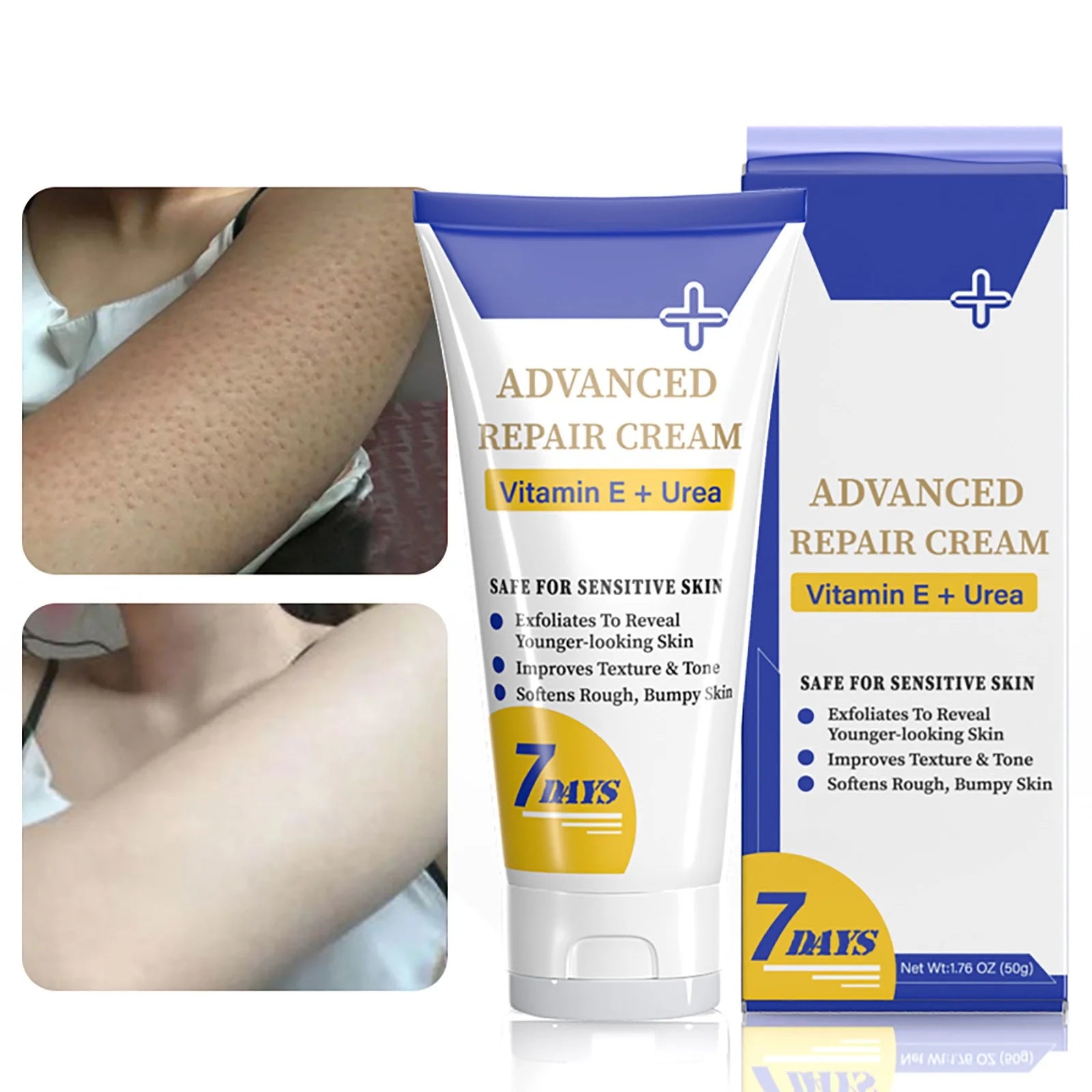 Beauty & Personal Care Keratosis Keratosis Moisturizing Strawberry Legs Body Scrub 