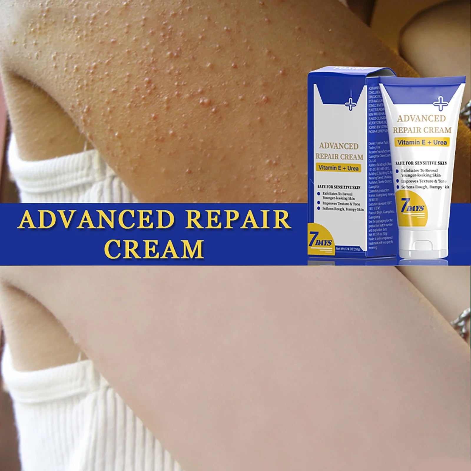 Beauty & Personal Care Keratosis Keratosis Moisturizing Strawberry Legs Body Scrub 